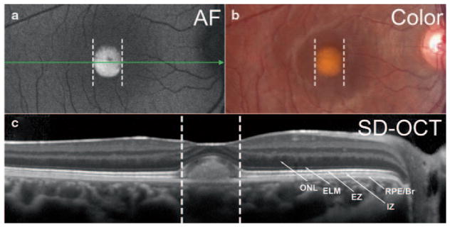 Fig. 38.1