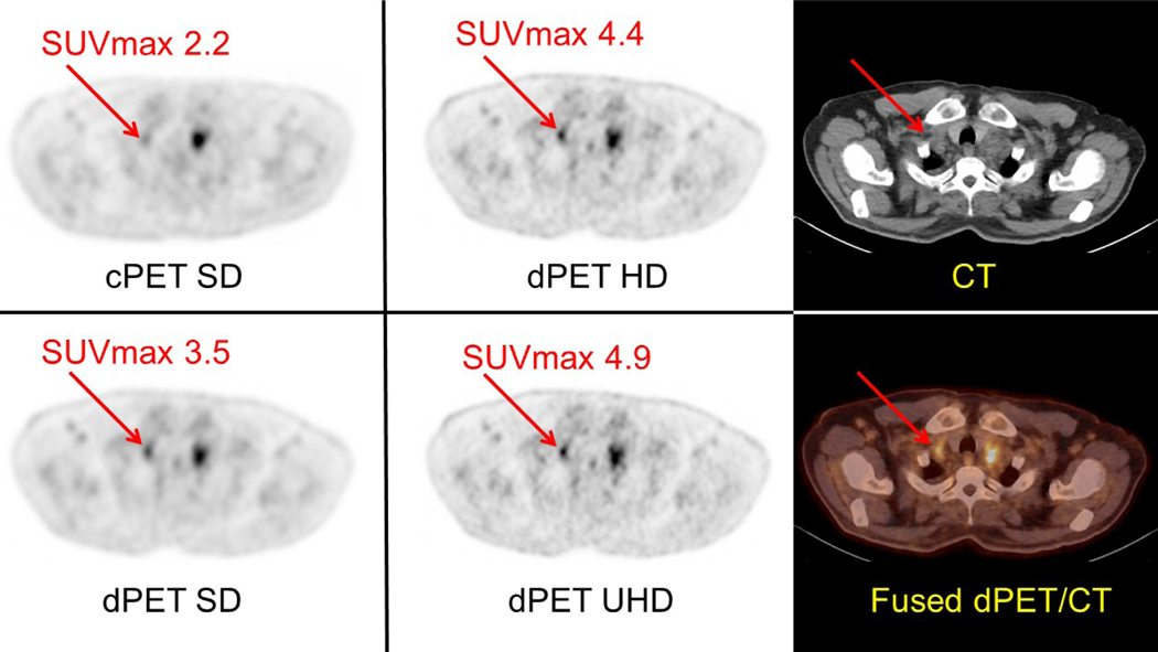 Figure 4: