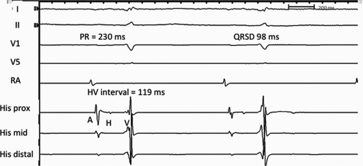 Figure 2: