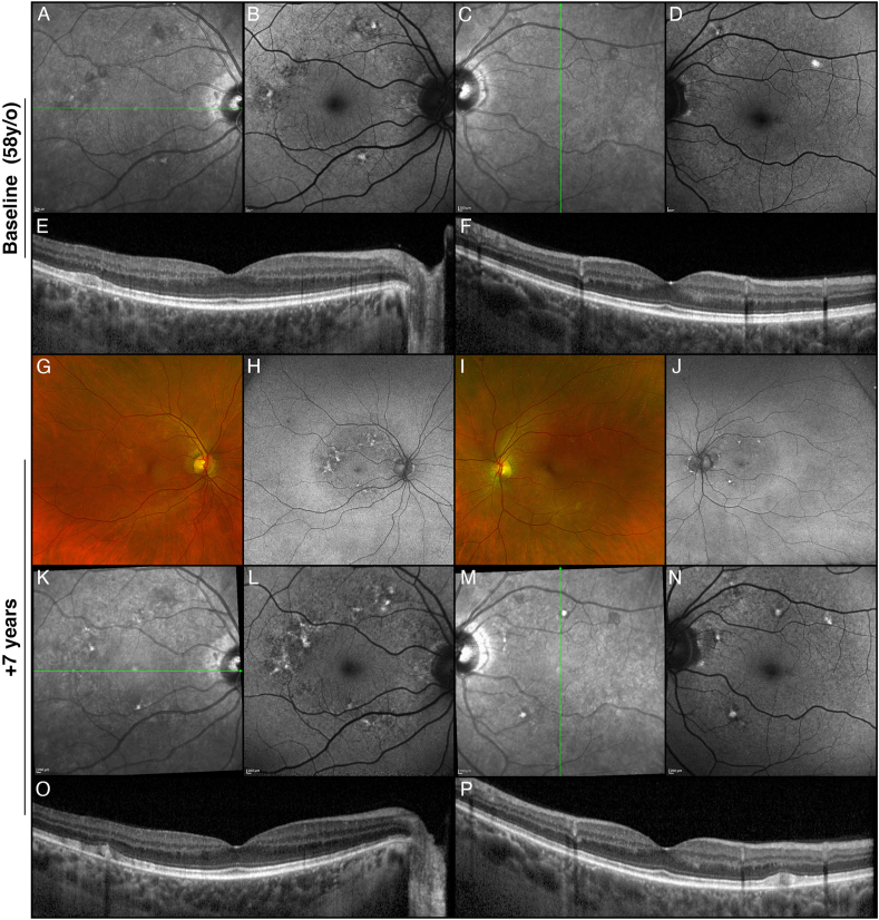 Fig. 4