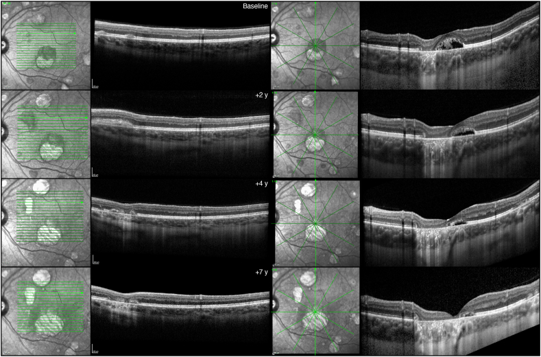 Fig. 2