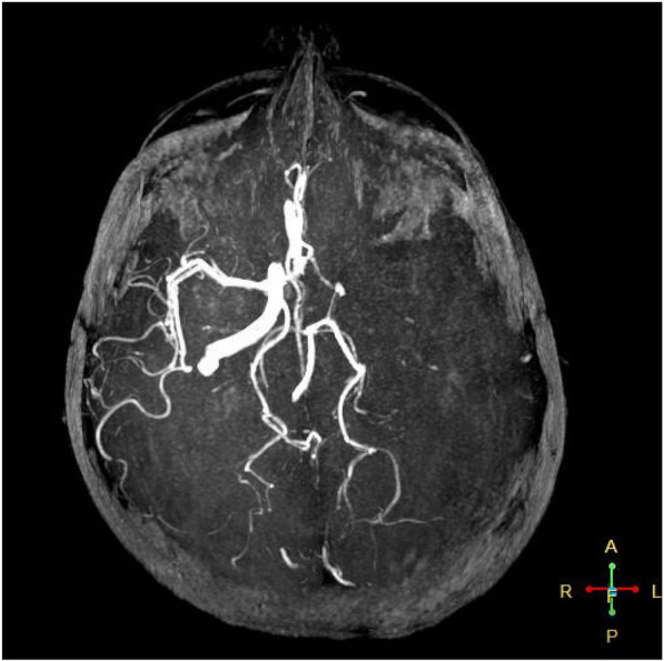 Fig. 2