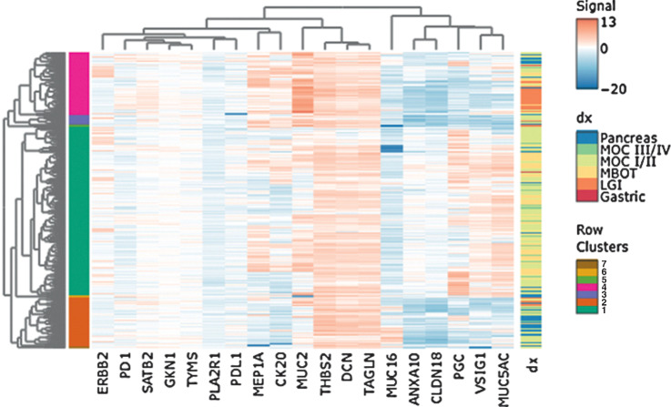 Figure 3. Heat map of unsupervised clustering analysis. Contains all samples with a concordant pathology diagnosis (n = 497), with MOC grouped by FIGO stage. Labels show main clusters and diagnoses. Gene-expression values are normalized and logarithm base 2 transformed. Dx, diagnosis.