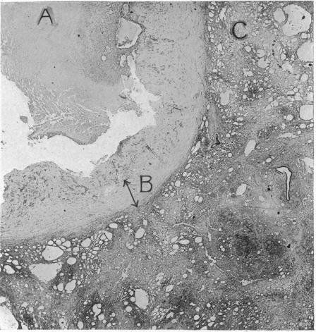 FIG. 14.