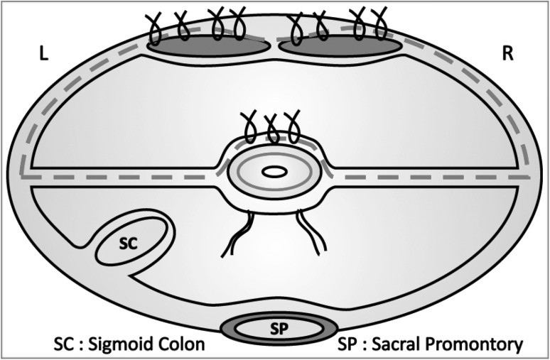 Fig. 2