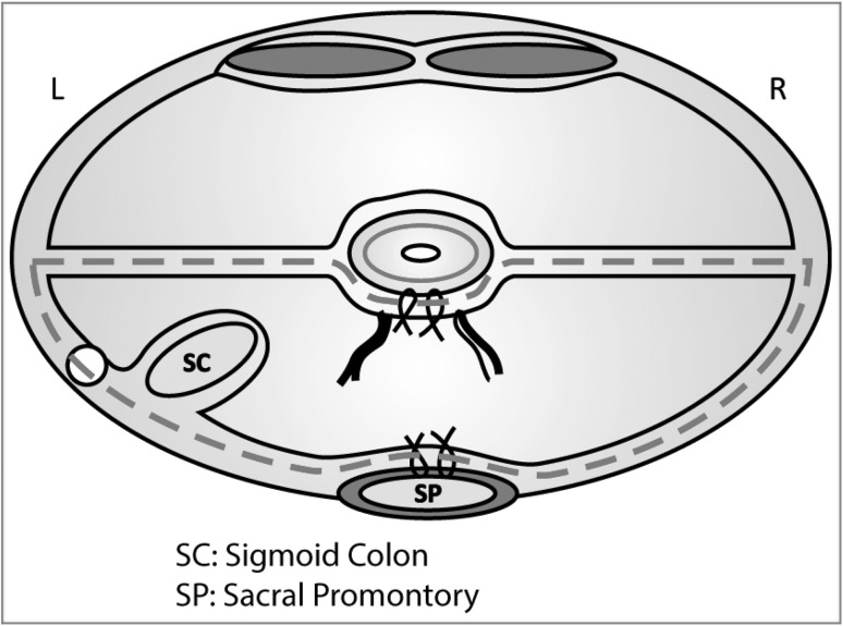 Fig. 1