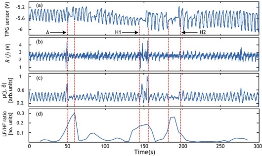 Figure 12.