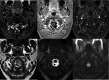 Fig 3.