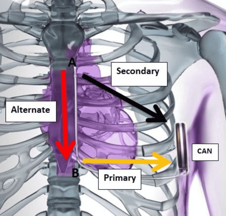 Figure 4