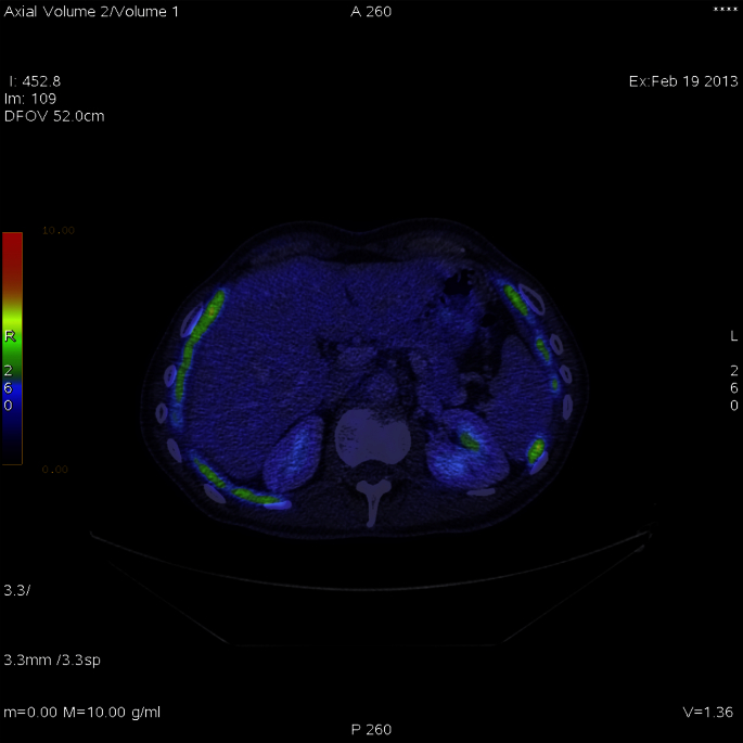 Fig. 1