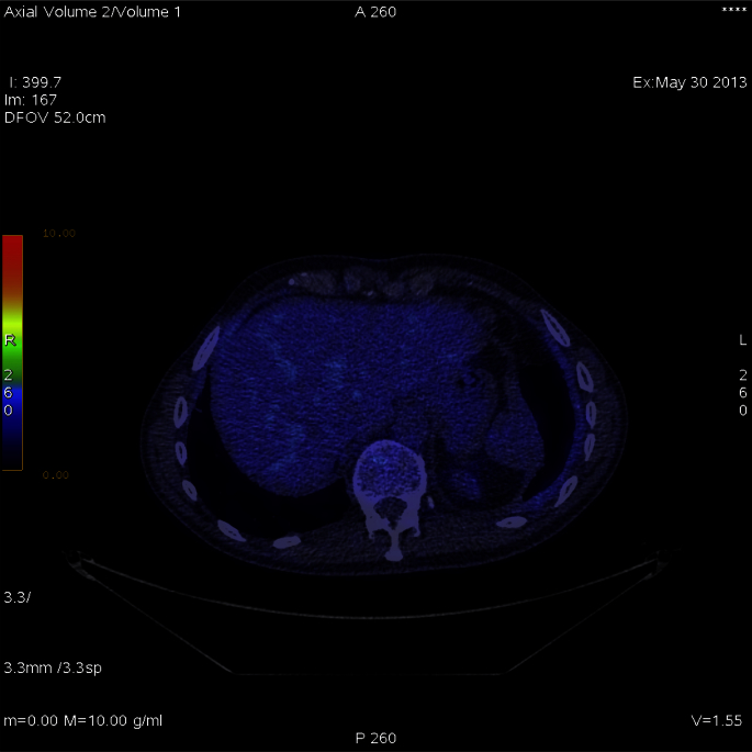 Fig. 4