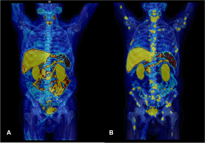 Fig. 4