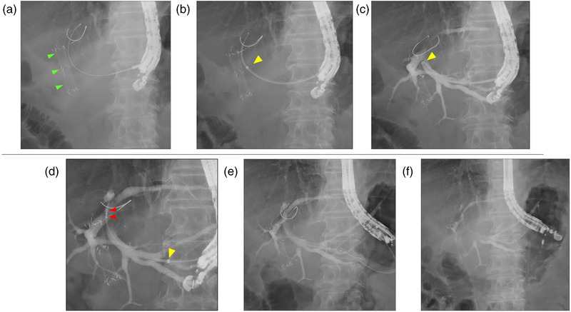 FIGURE 3