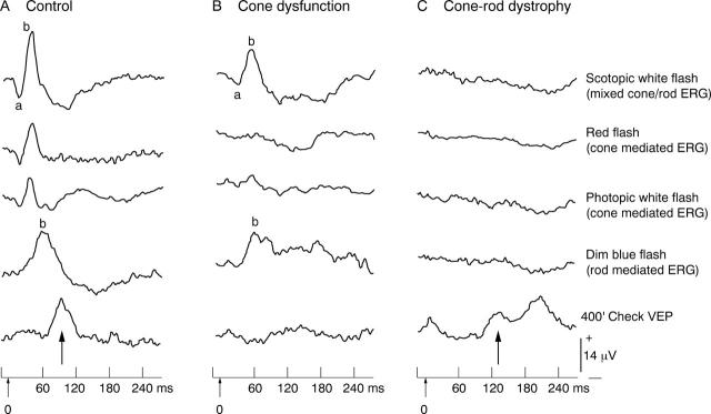 Figure 1  