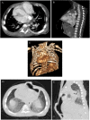 Fig 3