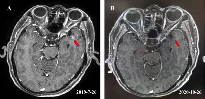 Figure 2