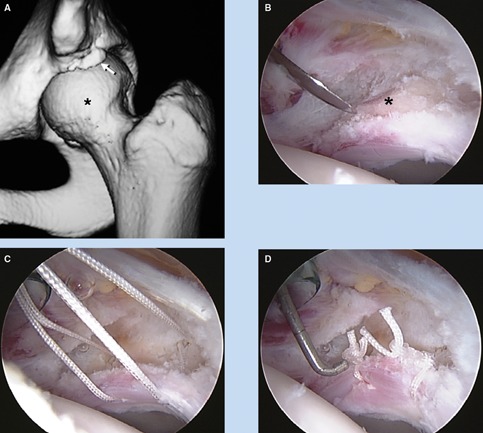 Figure 3.