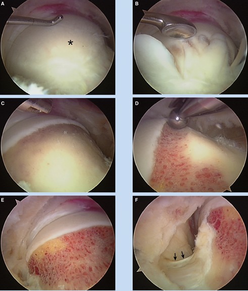 Figure 6.