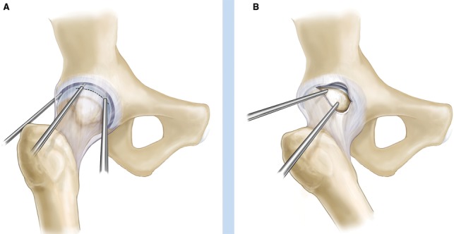 Figure 5.