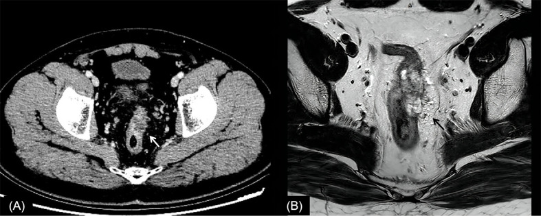 Figure 2