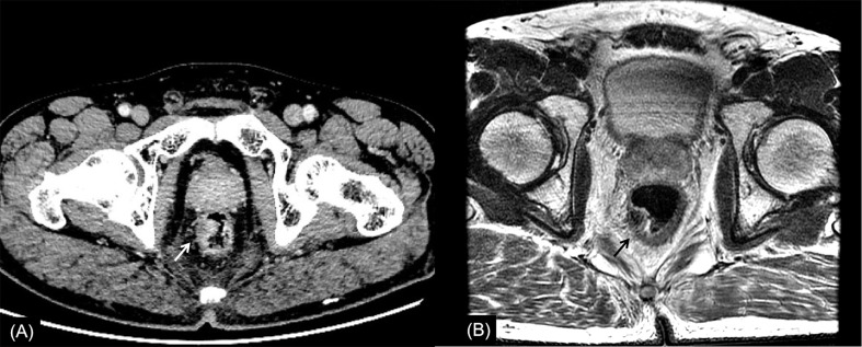 Figure 3