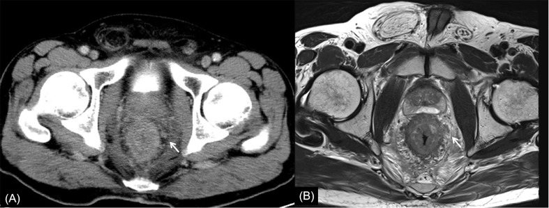 Figure 6