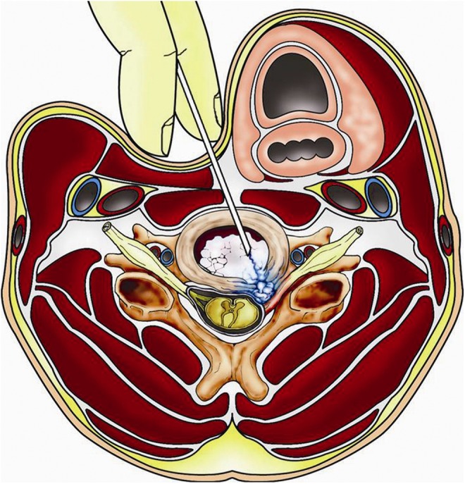 FIG. 1.