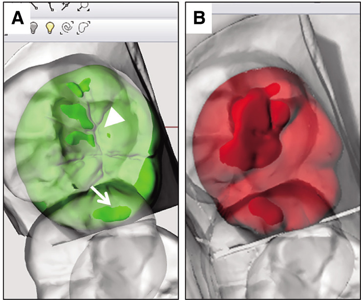 Fig. 3