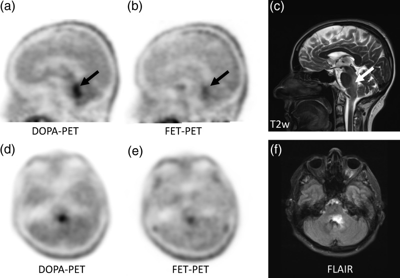 Fig. 3.