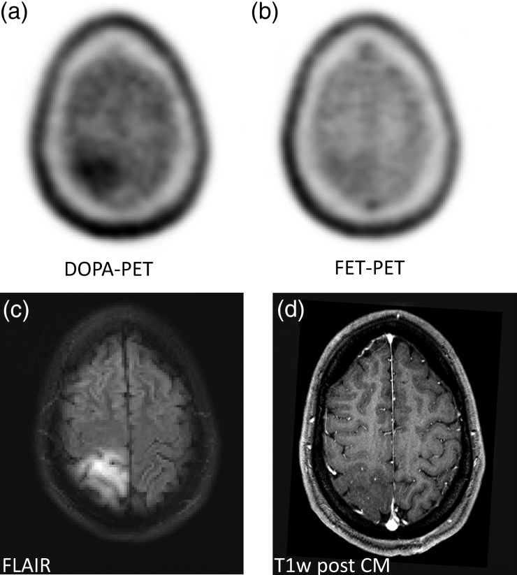 Fig. 5.