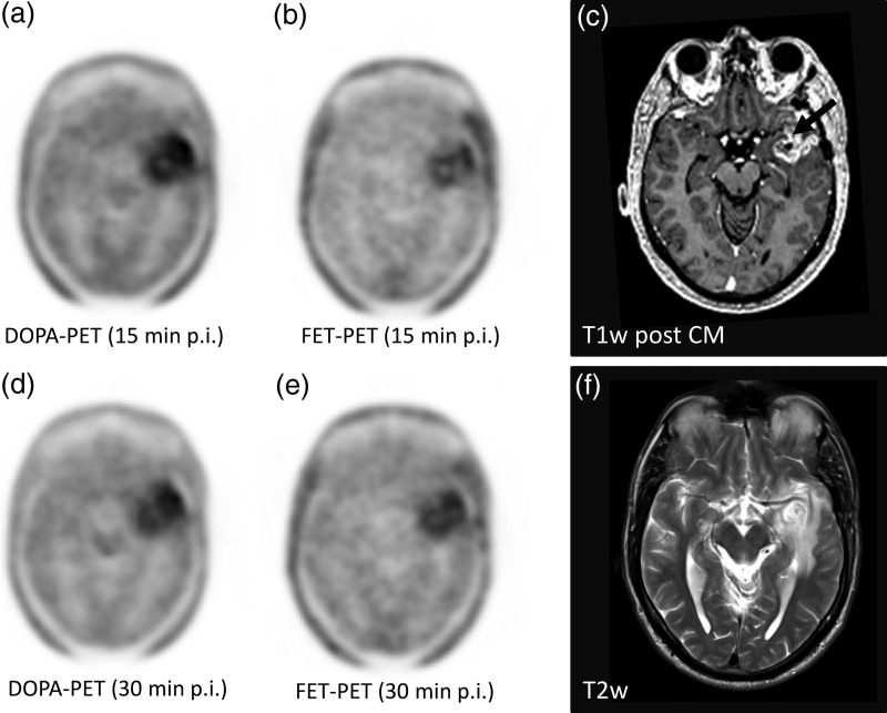 Fig. 2.