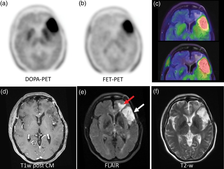 Fig. 4.