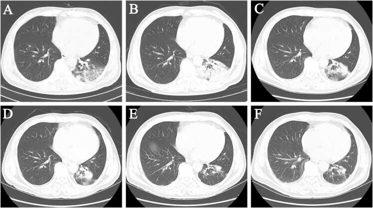 Fig. 1