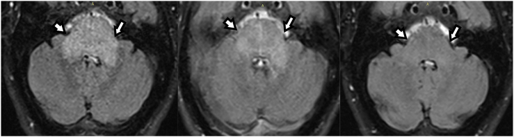 Fig. 5