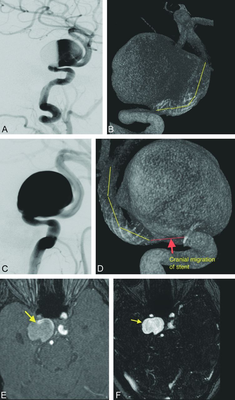 Fig 1.