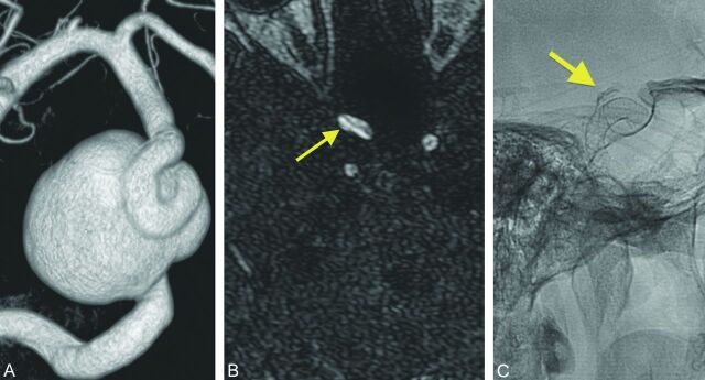 Fig 2.