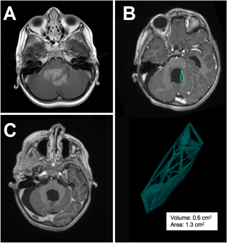 Fig. 2