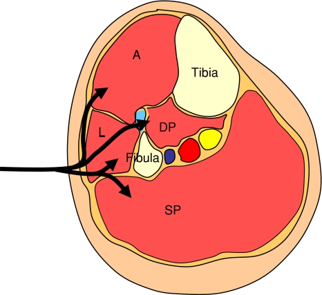 Fig. 1