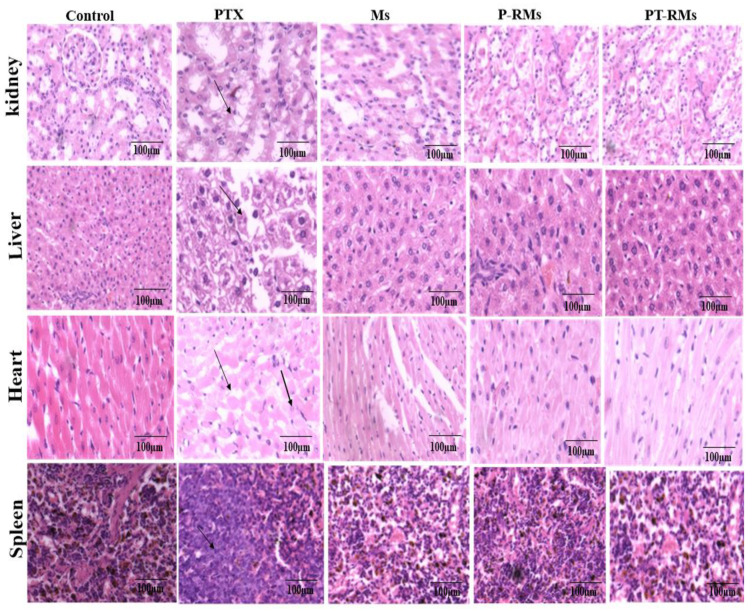 Figure 14