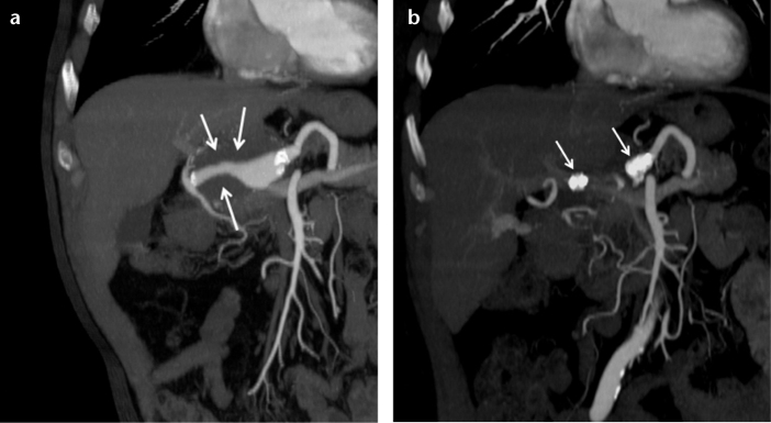 Figure 1. a, b.