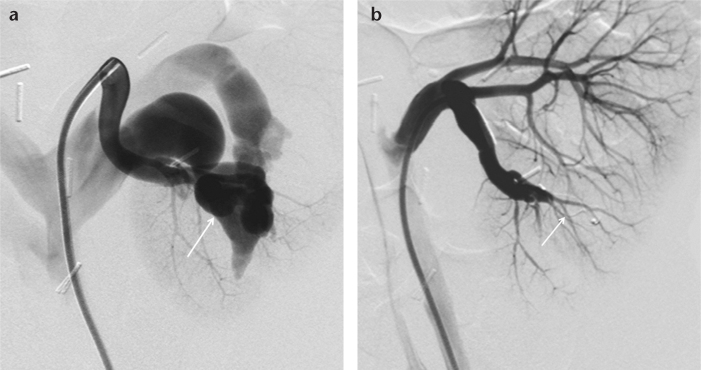 Figure 6. a, b.