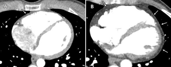 Figure 3: