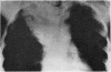 479