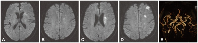 Fig. 1