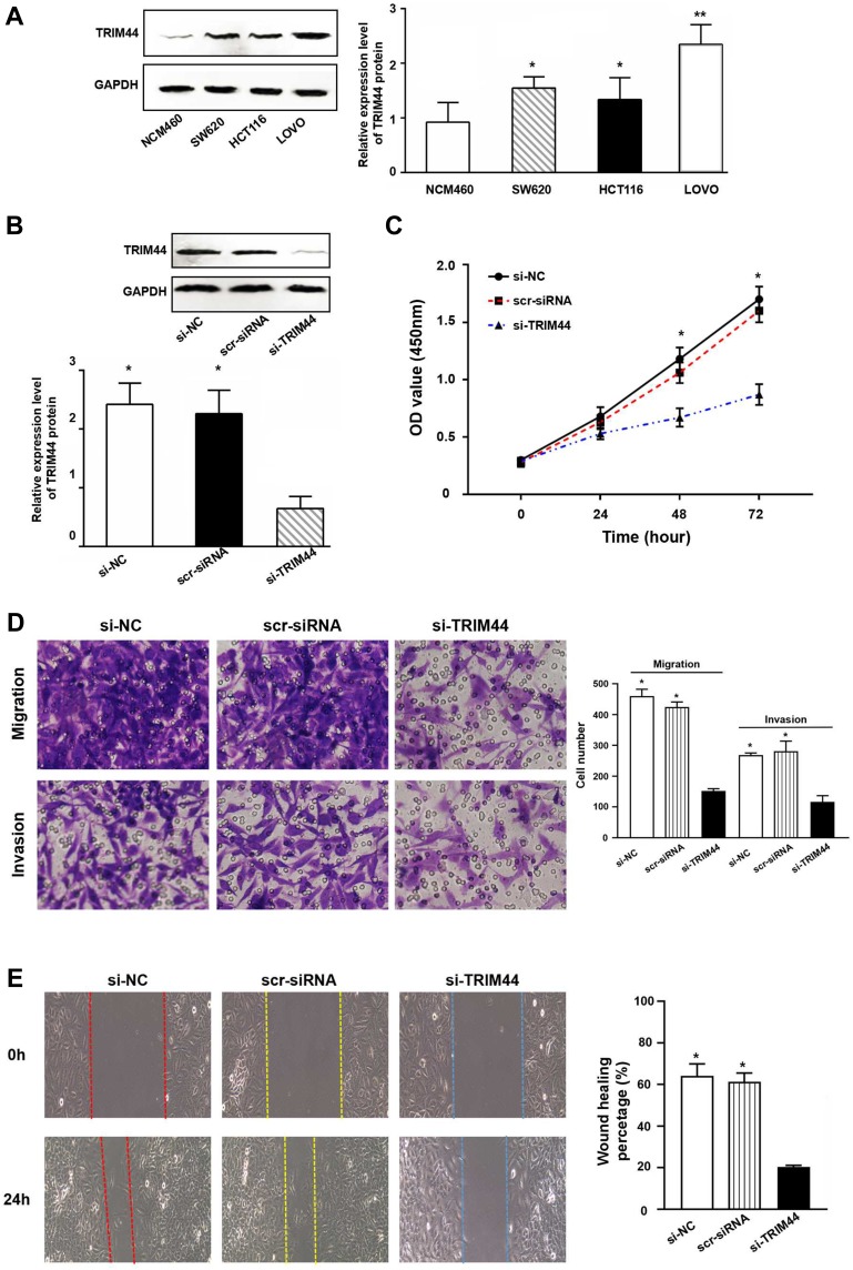 TRIM44 Promotes Colorectal Cancer Proliferation, Migration, and ...