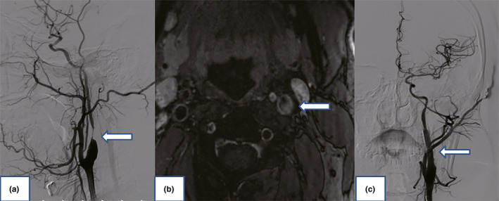 FIGURE 1