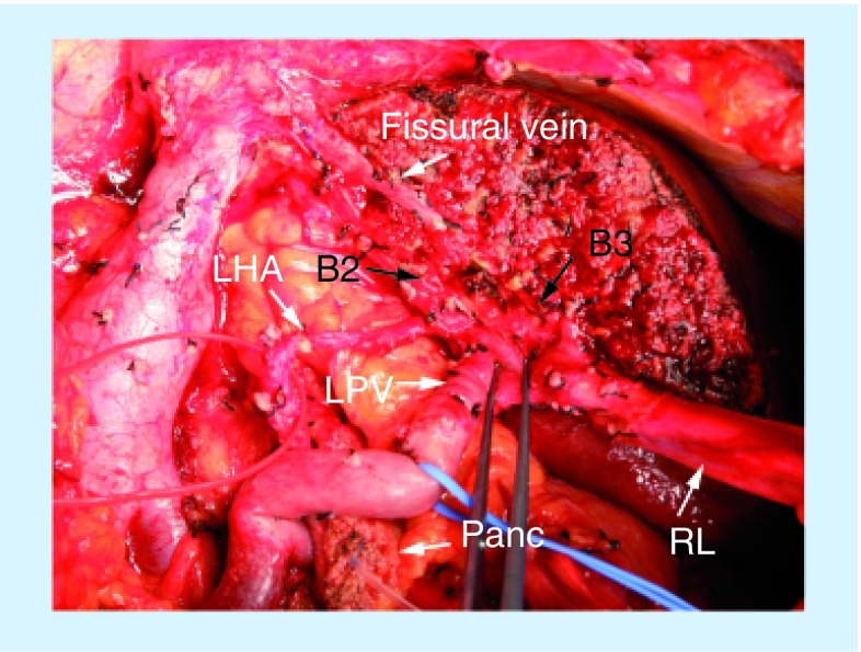 Figure 3.