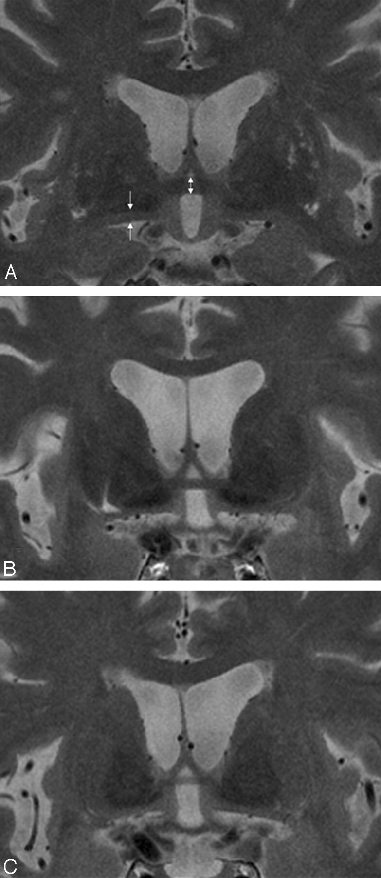 Fig 2.