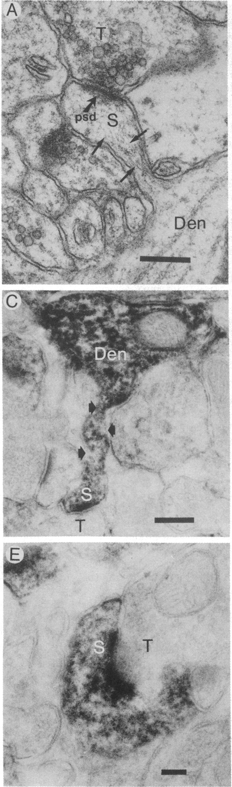 graphic file with name pnas00632-0261-a.jpg