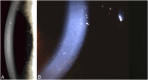 FIGURE 17.
